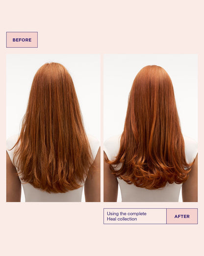 Sensitive Scalp Set
